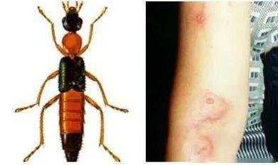 昆虫学者皮肤最新爆料,皮肤奥秘新发现